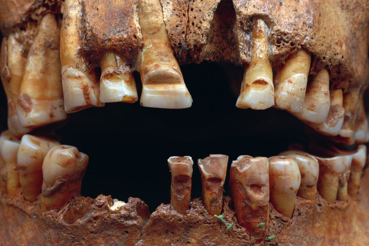 Lukas Kerk discusses the archeological findings and cultural significance of Viking Age body modifications discovered on Gotland.